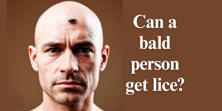 Why don’t bald people get lice?